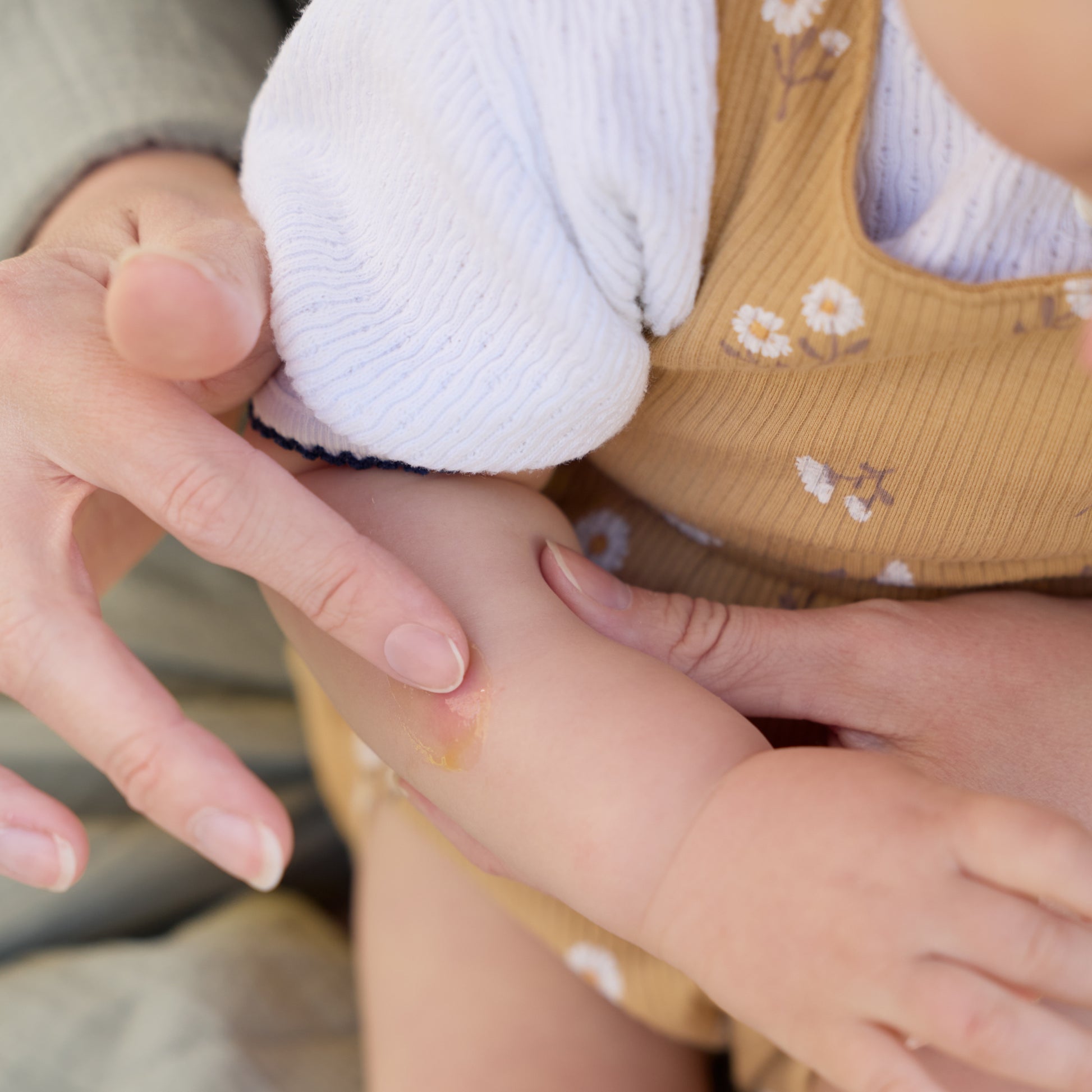 Baby & Kids Insektenstich-Gel