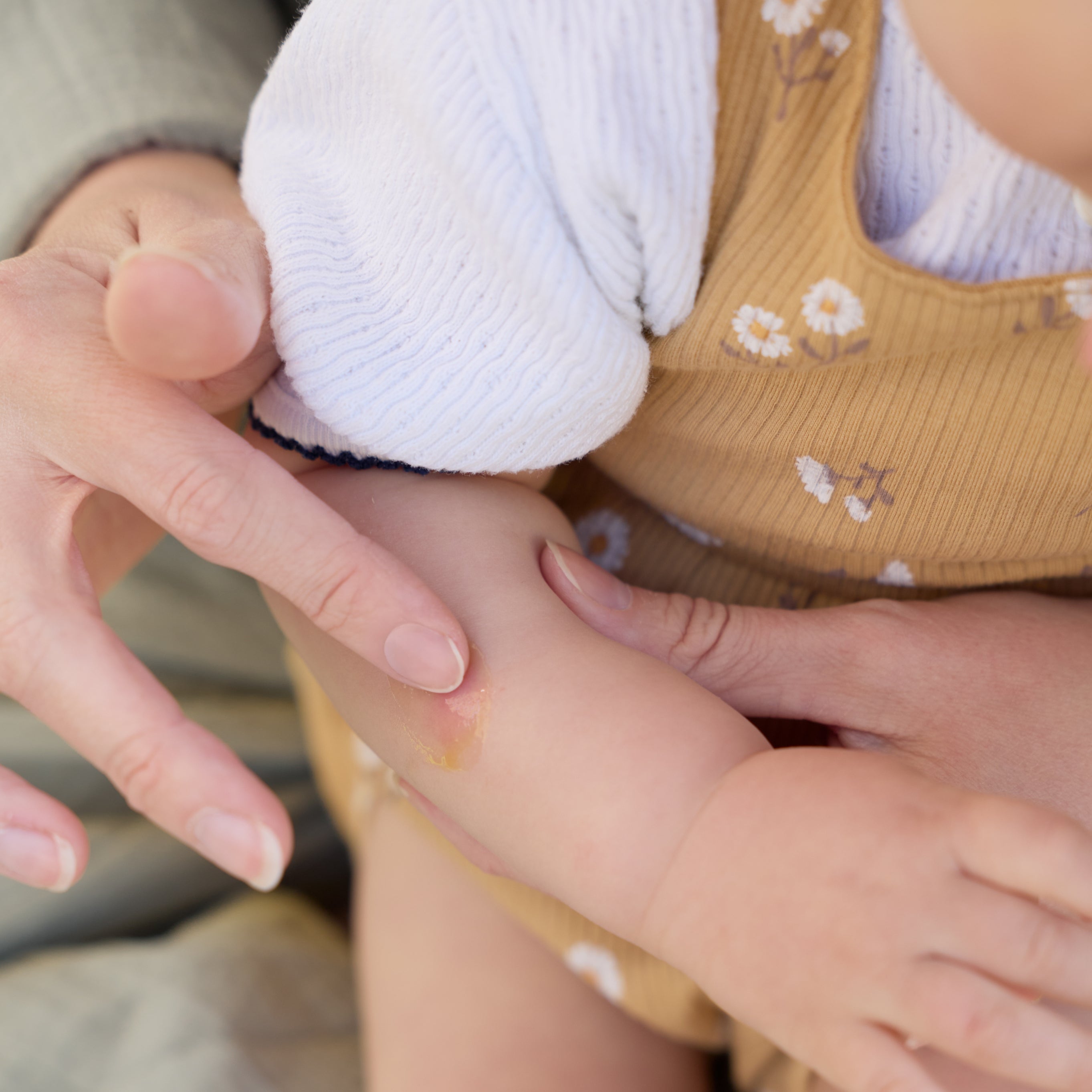 Baby & Kids Insektenstich-Gel
